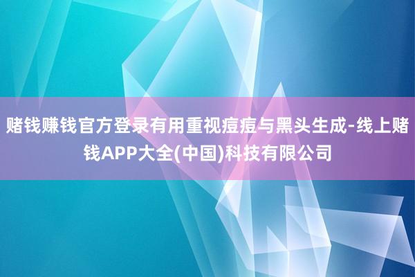 赌钱赚钱官方登录有用重视痘痘与黑头生成-线上赌钱APP大全(中国)科技有限公司